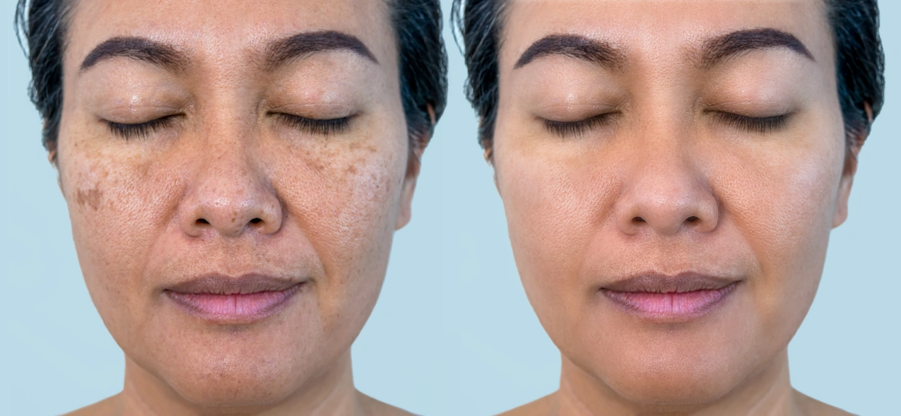 botox-sierra-vista