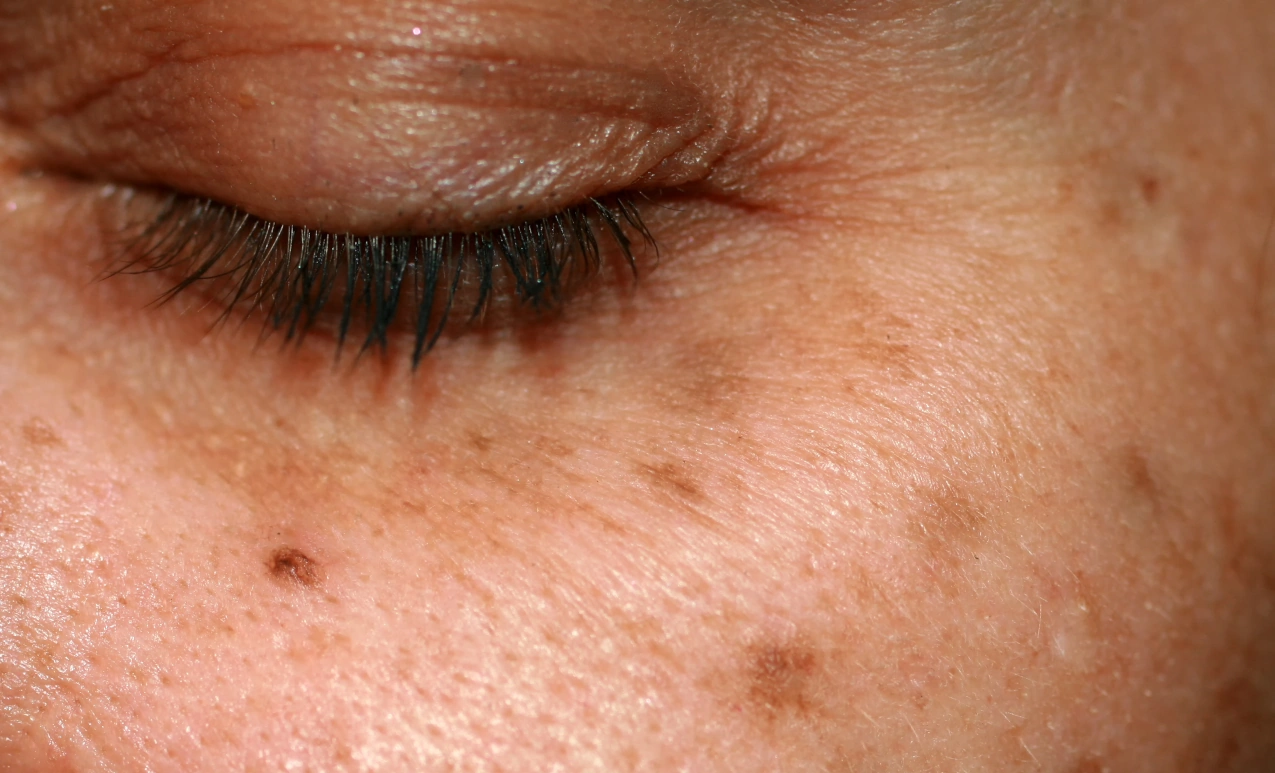 botox-treatments-sierra-vista