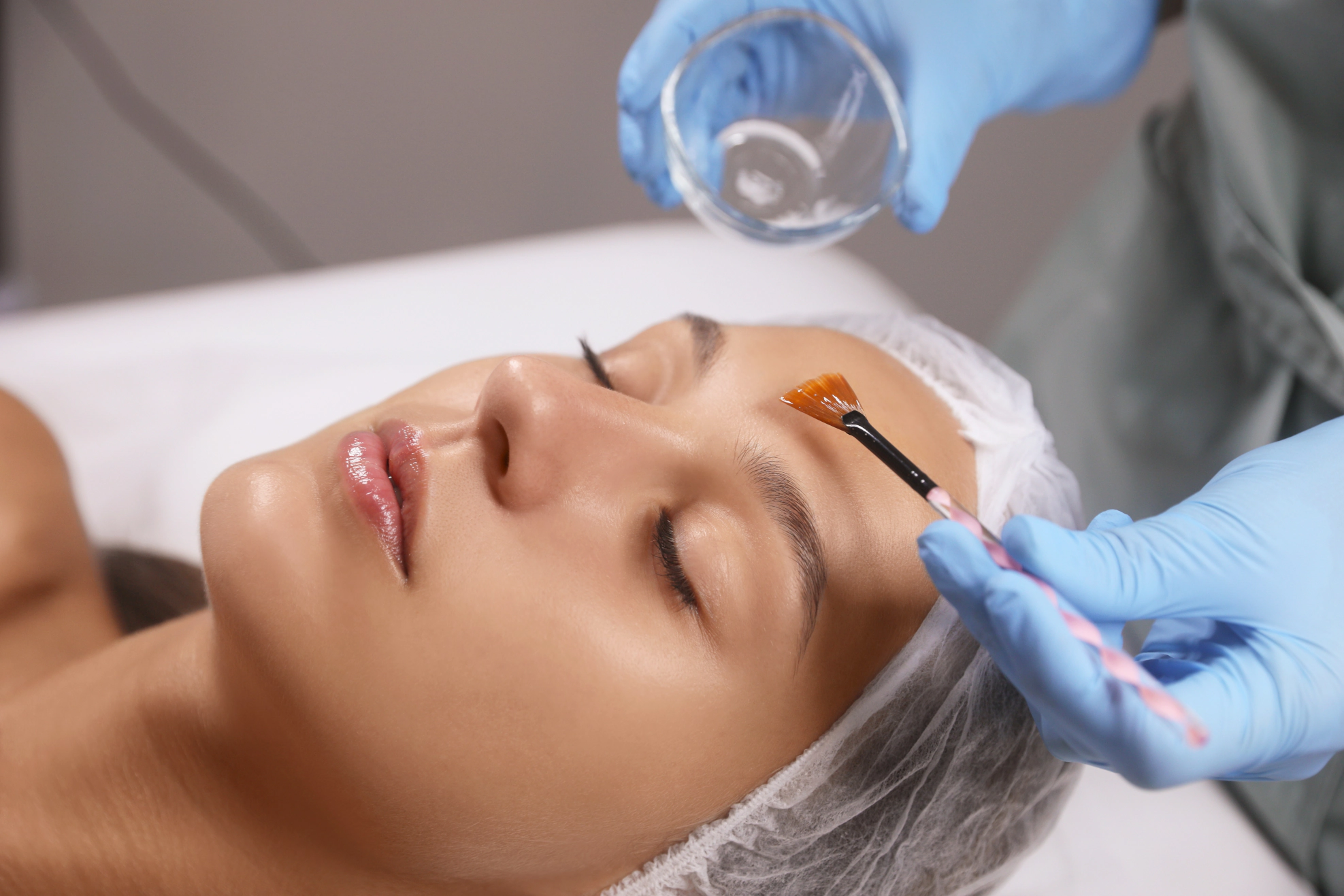 Chemical Peels Sierra Vista Gwynn Patterson